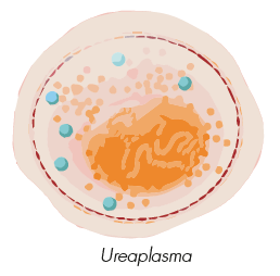 Ureaplasma